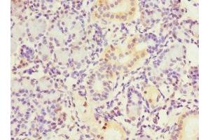 Immunohistochemistry of paraffin-embedded human pancreatic tissue using ABIN7149377 at dilution of 1:100 (NT5C3 anticorps  (AA 37-336))