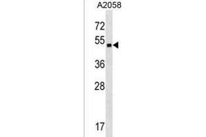 ZN Antibody (Center) (ABIN1538038 and ABIN2850129) western blot analysis in  cell line lysates (35 μg/lane). (ZNF559 anticorps  (AA 196-224))