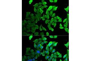 Immunofluorescence analysis of U2OS cells using SEPT2 Polyclonal Antibody (Septin 2 anticorps)