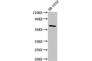 Western Blot Positive WB detected in: SH-SY5Y whole cell lysate All lanes: DEAF1 antibody at 3. (DEAF1 anticorps  (AA 73-200))