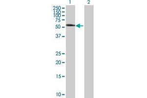 Western Blot analysis of KRT8 expression in transfected 293T cell line by KRT8 MaxPab polyclonal antibody. (KRT8 anticorps  (AA 1-483))