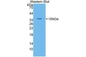 Detection of Recombinant TGM3, Mouse using Polyclonal Antibody to Transglutaminase 3, Epidermal (TGM3)