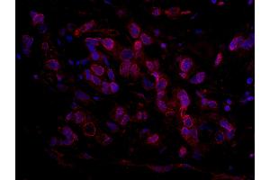 Immunofluorescence (IF) image for anti-RBP1-like protein (ARID4B) (AA 125-175) antibody (ABIN7448931) (BRCAA1 anticorps  (AA 125-175))