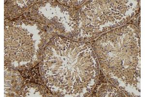 ABIN6276860 at 1/100 staining Mouse testis tissue by IHC-P. (CD1d anticorps  (Internal Region))