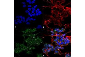 Immunocytochemistry/Immunofluorescence analysis using Rabbit Anti-RAB1B Polyclonal Antibody (ABIN5066507).