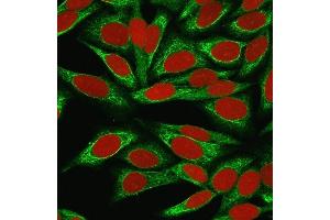 Immunofluorescence Analysis of MeOH-fixed HeLa cells labeled with CDw75 Mouse Monoclonal Antibody (LN-1) followed by goat anti-Mouse IgG-CF488 (Green). (ST6GAL1 anticorps)