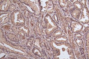 Immunohistochemistry of paraffin-embedded human thyroid tissue using ABIN7164566 at dilution of 1:100 (ZDHHC12 anticorps  (AA 121-197))