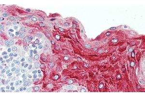 Detection of ECM1 in Human Tonsil Tissue using Polyclonal Antibody to Extracellular Matrix Protein 1 (ECM1)
