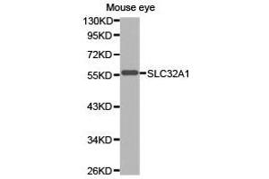 Western Blotting (WB) image for anti-Solute Carrier Family 32 (GABA Vesicular Transporter), Member 1 (SLC32A1) antibody (ABIN1874828) (SLC32A1 anticorps)