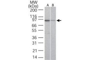 Western blot analysis of TLR5 in A) Ramos and B) Raw cell lysate using TLR5 monoclonal antibody, clone 19D759. (TLR5 anticorps  (AA 700-800))