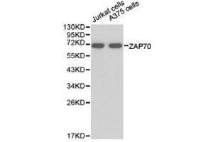 Western Blotting (WB) image for anti-zeta-Chain (TCR) Associated Protein Kinase 70kDa (ZAP70) antibody (ABIN1875382) (ZAP70 anticorps)