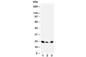 Western blot testing of DUSP3 antibody and Lane 1:  rat testis (Dual Specificity Phosphatase 3 (DUSP3) (C-Term) anticorps)