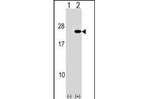 Western blot analysis of IP2 (arrow) using rabbit polyclonal IP2 Antibody (N-term) (ABIN1539498 and ABIN2848464). (PAIP2 anticorps  (N-Term))
