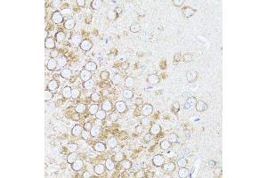Immunohistochemistry of paraffin-embedded rat brain using ARRB1 antibody.