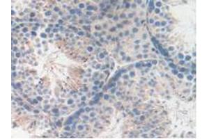 Figure. (LAMP2 anticorps  (AA 295-410))