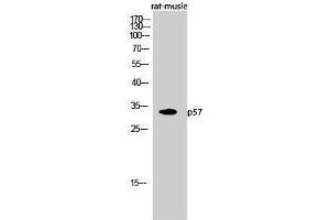 Western Blotting (WB) image for anti-P57 (N-Term) antibody (ABIN3180791) (P57 (N-Term) anticorps)