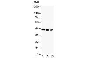 Western blot testing of CCR6 antibody and Lane 1:  rat liver;  2: SW620;  3: CEM cell lysate (CCR6 anticorps  (C-Term))