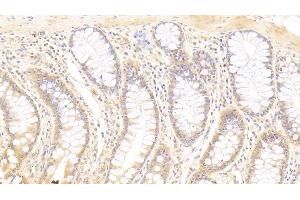 Detection of ST2 in Human Colon Tissue using Polyclonal Antibody to Syntenin 2 (ST2) (SDCBP2 anticorps  (AA 1-292))