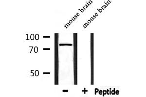 Western blot analysis of extracts from mouse brain, using TICAM1  Antibody.