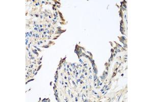 Immunohistochemistry of paraffin-embedded human lung using GPI antibody. (GPI anticorps  (AA 1-280))