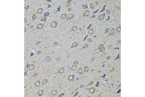 Immunohistochemistry of paraffin-embedded rat brain using COL1A2 antibody.