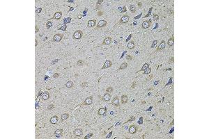 Immunohistochemistry of paraffin-embedded rat brain using COL1A2 antibody. (COL1A2 anticorps)