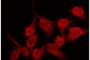 ABIN6267287 staining MDA-MB-435 by IF/ICC.