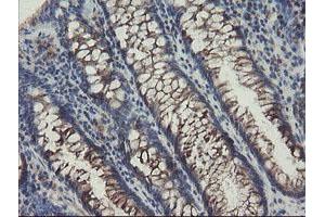 Immunohistochemical staining of paraffin-embedded Human colon tissue using anti-SENP2 mouse monoclonal antibody. (SENP2 anticorps  (AA 139-523))