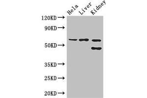 Western Blot Positive WB detected in: Hela whole cell lysate, Mouse liver tissue, Mouse kidney tissue All lanes: EHD2 antibody at 3 μg/mL Secondary Goat polyclonal to rabbit IgG at 1/50000 dilution Predicted band size: 62, 47 kDa Observed band size: 62, 47 kDa (EHD2 anticorps  (AA 401-543))