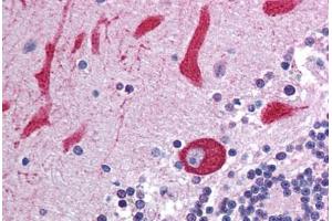 Human Brain, Cerebellum (formalin-fixed, paraffin-embedded) stained with TLR7 antibody ABIN214002 at 5 ug/ml followed by biotinylated goat anti-rabbit IgG secondary antibody ABIN481713, alkaline phosphatase-streptavidin and chromogen. (TLR7 anticorps)