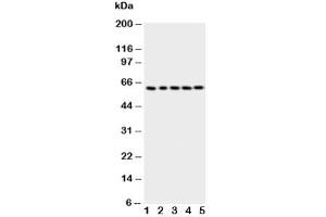 Western blot testing of p63 antbody (TCP1 alpha/CCTA anticorps  (AA 82-98))