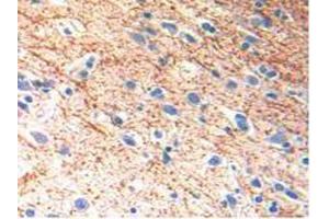 IHC-P analysis of Human Brain Tissue, with DAB staining. (IL-13 anticorps  (AA 25-146))