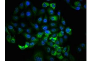 Immunofluorescence staining of Hela cells with ABIN7127744 at 1:100,counter-stained with DAPI.