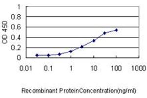 Detection limit for recombinant GST tagged RIPK4 is approximately 0. (RIPK4 anticorps  (AA 675-784))