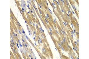 Immunohistochemistry of paraffin-embedded Rat heart using TYR Polyclonal Antibody at dilution of 1:100 (40x lens). (TYR anticorps)
