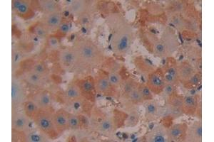 Detection of COX 2 in Human Liver Tissue using Polyclonal Antibody to Cyclooxygenase-2 (COX 2)