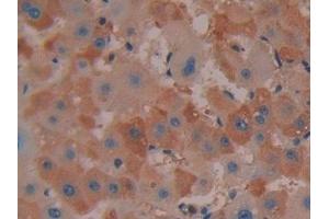 Detection of COX 2 in Human Liver Tissue using Polyclonal Antibody to Cyclooxygenase-2 (COX 2) (PTGS2 anticorps  (AA 187-425))