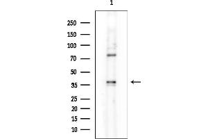 anti-Zinc Finger Protein 696 (ZNF696) antibody