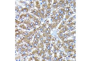 Immunohistochemistry of paraffin-embedded rat liver using  antibody (ABIN7265709) at dilution of 1:100 (40x lens). (ATG3 anticorps)