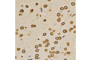 Immunohistochemistry of paraffin-embedded rat brain using LMNA antibody at dilution of 1:200 (x400 lens). (Lamin A/C anticorps)