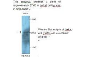 Image no. 1 for anti-PRKC, Apoptosis, WT1, Regulator (PAWR) antibody (ABIN790827) (PAWR anticorps)