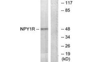 Western blot analysis of extracts from NIH-3T3 cells, using NPY1R Antibody. (NPY1R anticorps  (AA 221-270))