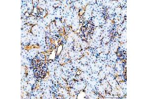 IHC analysis of CD31/Pecam1 using anti-CD31/Pecam1 antibody (ABIN7601662). (CD31 anticorps  (AA 41-258))