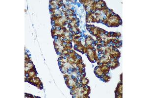 Immunohistochemistry of paraffin-embedded Rat pancreas using IER5 Rabbit pAb (ABIN7267843) at dilution of 1:100 (40x lens). (IER5 anticorps)
