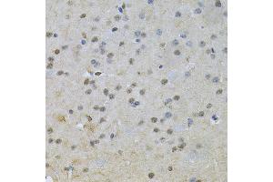 Immunohistochemistry of paraffin-embedded mouse brain using NRF1 Antibody (ABIN6290682) at dilution of 1:100 (40x lens). (NRF1 anticorps)