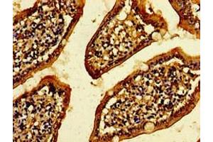 Immunohistochemistry of paraffin-embedded human small intestine tissue using ABIN7175009 at dilution of 1:100 (CXorf56 anticorps  (AA 1-222))