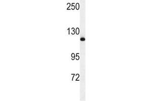 Western blot analysis of NEDD4 antibody and mouse NIH3T3 lysate