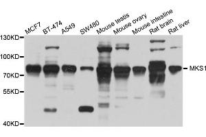 Western blot analysis of extracts of various cell lines, using MKS1 antibody (ABIN5995499) at 1/1000 dilution. (MKS1 anticorps)