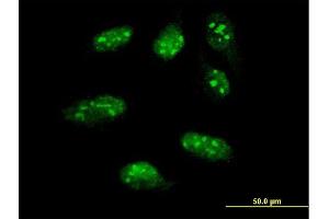 Immunofluorescence of monoclonal antibody to LHX1 on HeLa cell. (LHX1 anticorps  (AA 1-100))