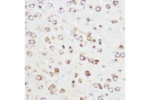 Immunohistochemistry of paraffin-embedded rat brain using NOMO1 Rabbit pAb (ABIN6128346, ABIN6144710, ABIN6144711 and ABIN6214793) at dilution of 1:350 (40x lens). (NOMO1 anticorps  (AA 700-1000))